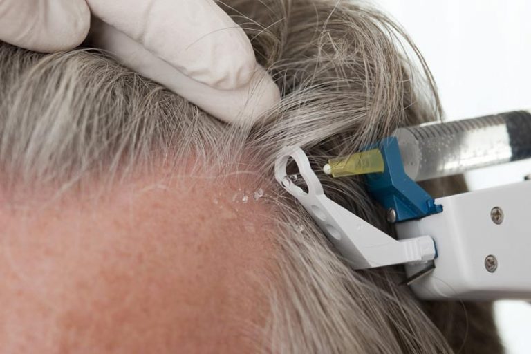 Mesotherapie · Marva Aesthetics · Marva Schreiber Köln